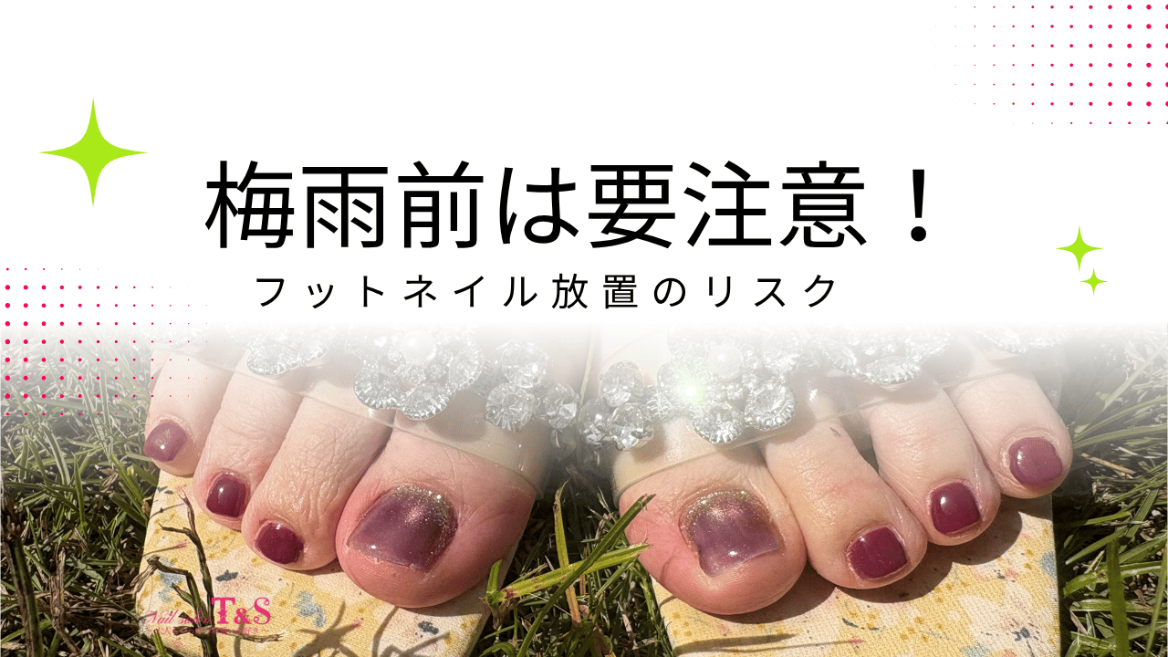 梅雨前に注意したいフットネイル放置のリスクを解説するアイキャッチ画像